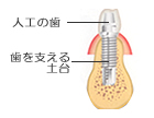 二次手術について